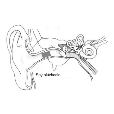 spionazne sluchadlo do cuha ako ho umiesnit pouzitie spy slchadla 