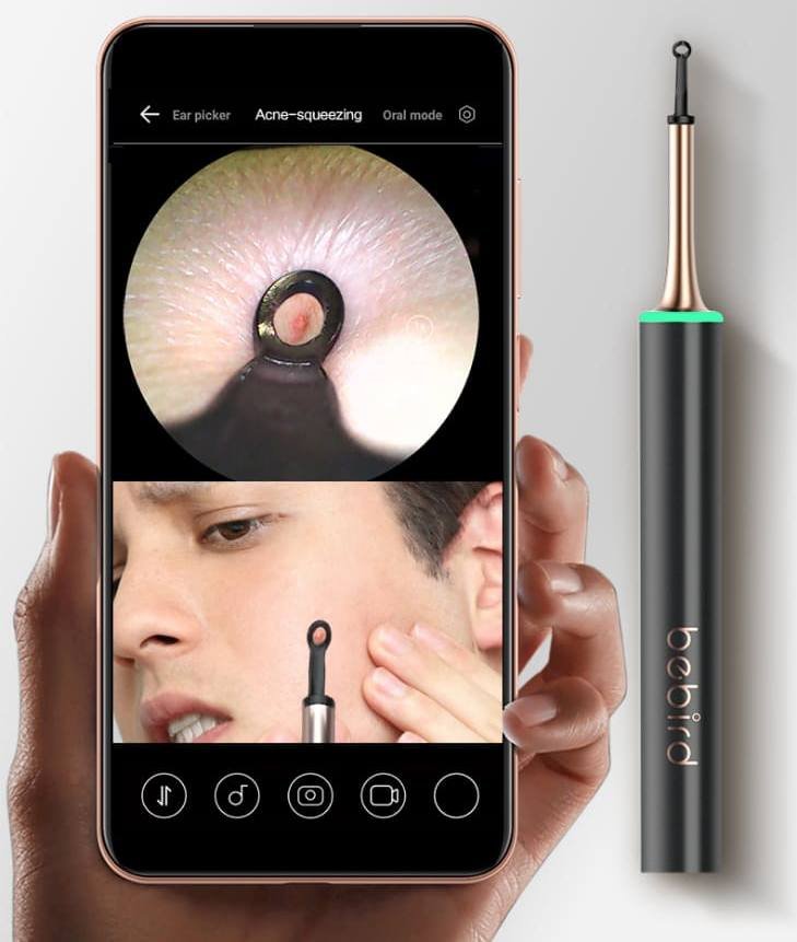 Čistič uší a pleti – zariadenie s FULL HD kamerou a WiFi aplikáciou pre smartphone (iOS / Android)