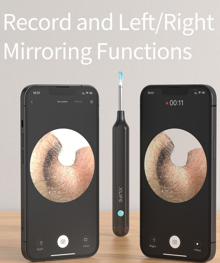 Čistič uší – odstraňovač ušního mazu s bezdrátovou orální FULL HD kamerou + WiFi app