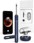 Smart čistič ucha – kamera 10 Mpx + WiFi aplikácia + 27 doplnkov