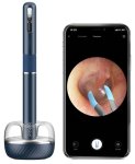 Smart čistič ucha – kamera 10 Mpx + WiFi aplikácia + 27 doplnkov