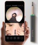 Čistič uší a pleti – zariadenie s FULL HD kamerou a WiFi aplikáciou pre smartphone (iOS / Android)