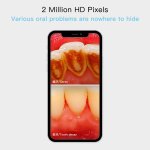Kamera do úst s fotoaparátom - dentálna kamera FULL HD WiFi + 8x LED + Krytie IP67