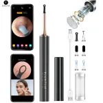 Čistič uší a pleti – zariadenie s FULL HD kamerou a WiFi aplikáciou pre smartphone (iOS / Android)